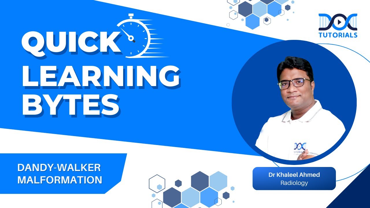 #QuickLearningByte | DANDY-WALKER MALFORMATION - RADIOLOGY  | DR KHALEEL AHMED  | DOCTUTORIAL'S
