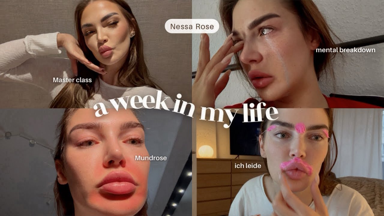 Mundrose, Po Unterspritzung, Mental Breakdown, Masterclass, DM Haul und vieles mehr.. - XXXL VLOG