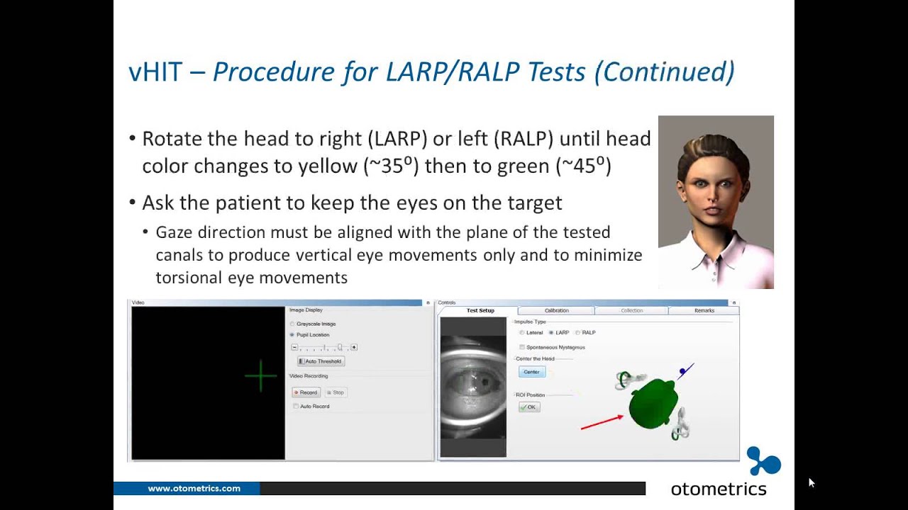 ICS Impulse vHIT: Review of test procedures and possible artifacts