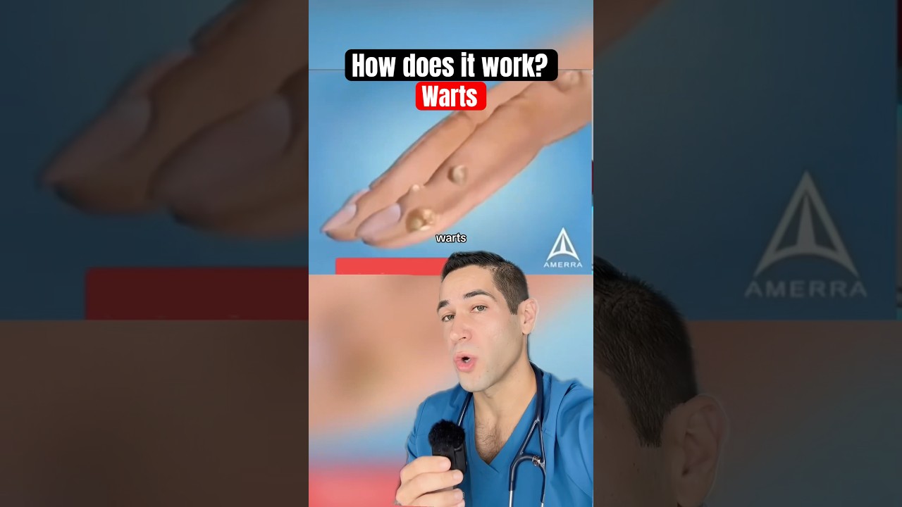 THIS is how warts work