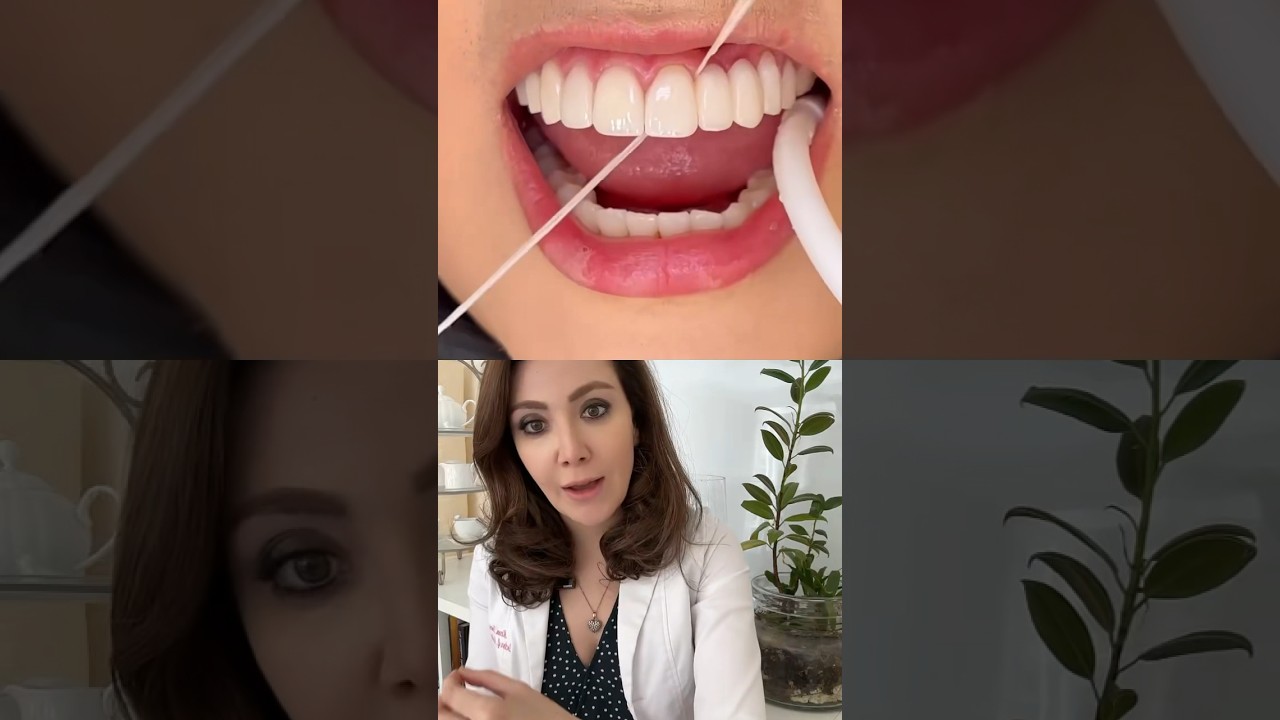 Jak wygląda nitkowanie zęb&oacute;w przy założonym moście dentystycznym?!