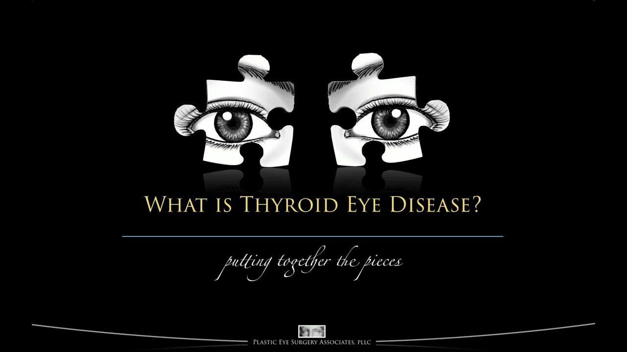 What is Thyroid Eye Disease
