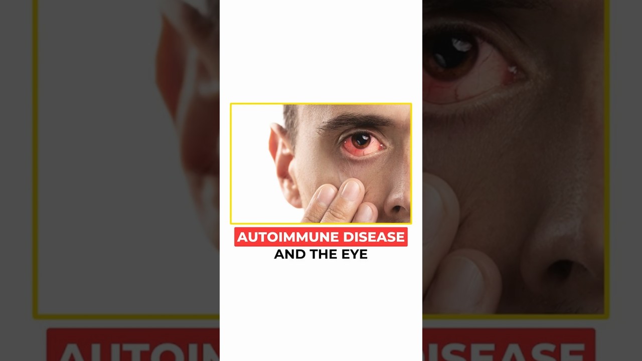 Связано ли ваше воспаление глаз с аутоиммунным заболеванием? | Объяснение симптомов и причин