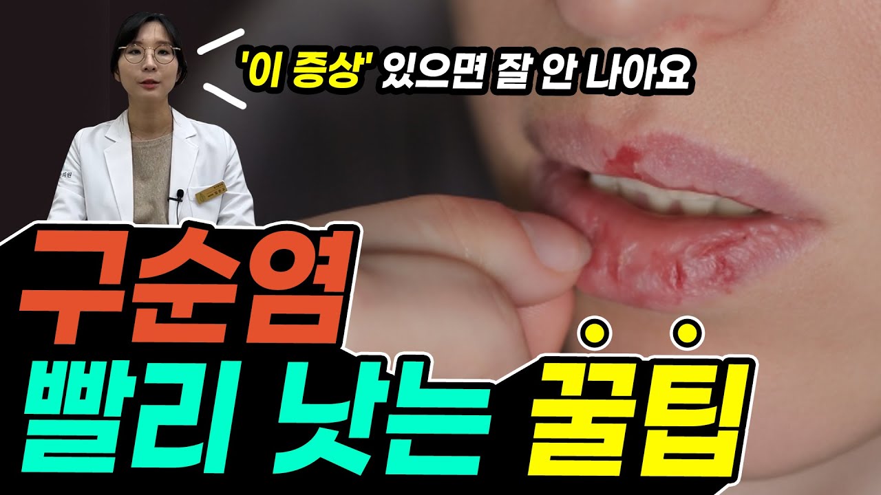 구순염 빨리 낫는 법 📌연고, 립밤 발라도 계속된다면 꼭 치료해야 할 '이것' (부제: 입술 각질, 열감, 진물의 핵심 원인은?)