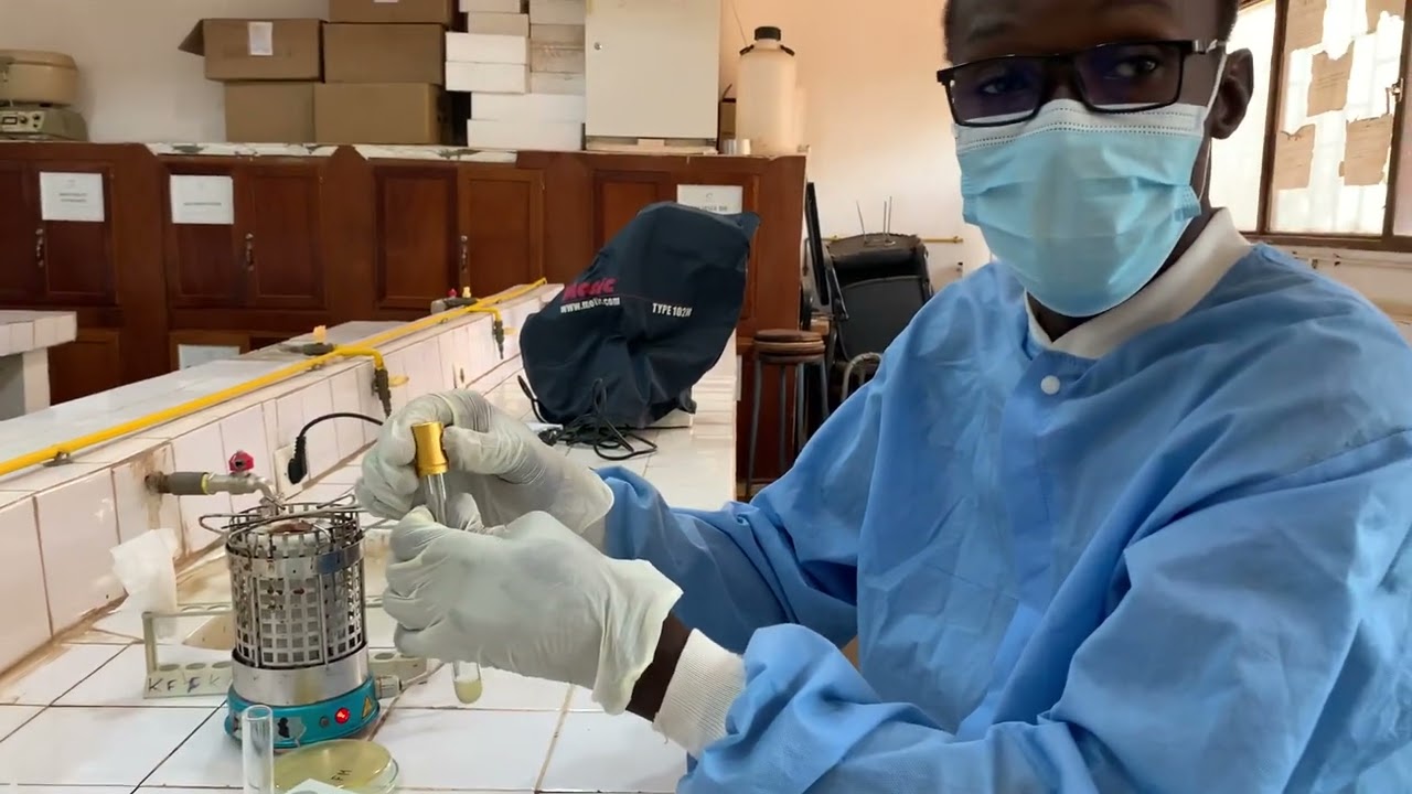 Technique de Mise en évidence de l urease chez les bactéries