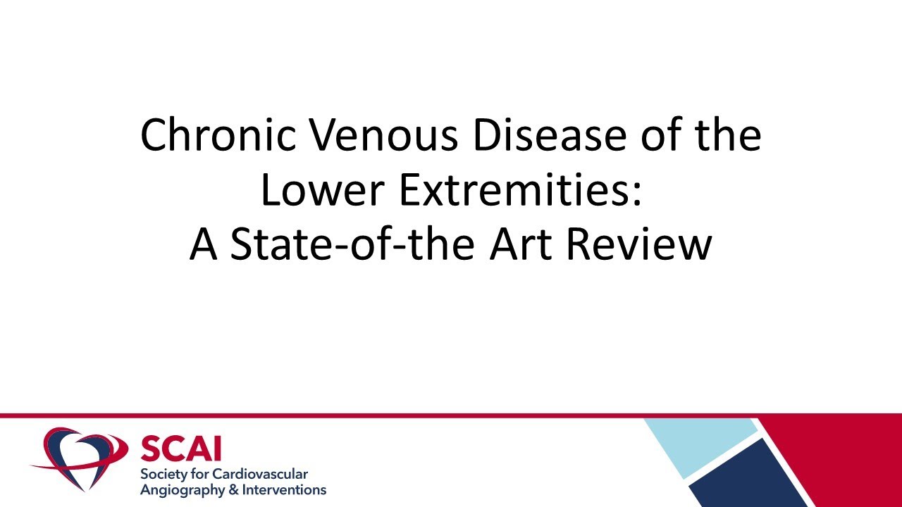 Conversations in Interventional Cardiology: Chronic Venous Disease of the Lower Extremities
