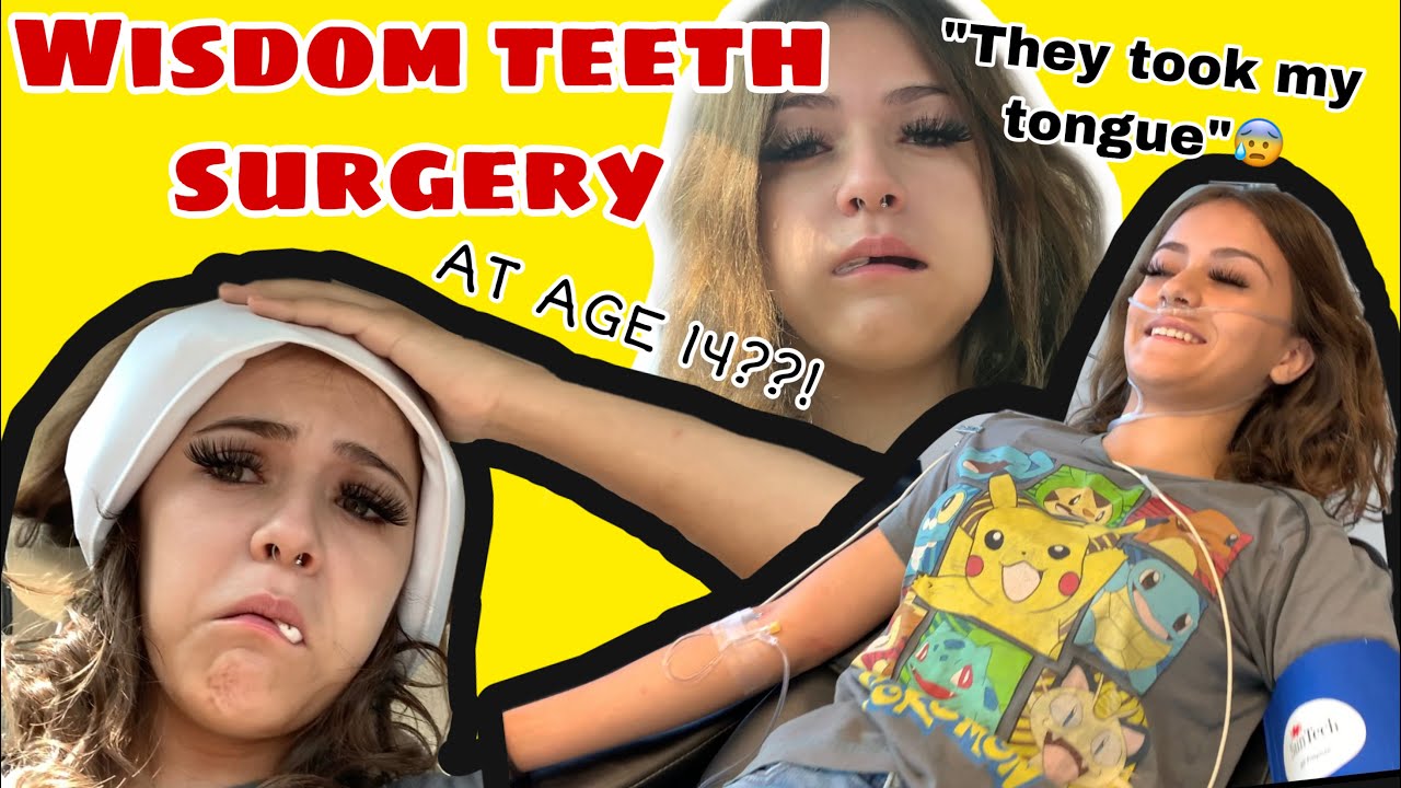 getting my wisdom teeth removed at 14 (part 1)