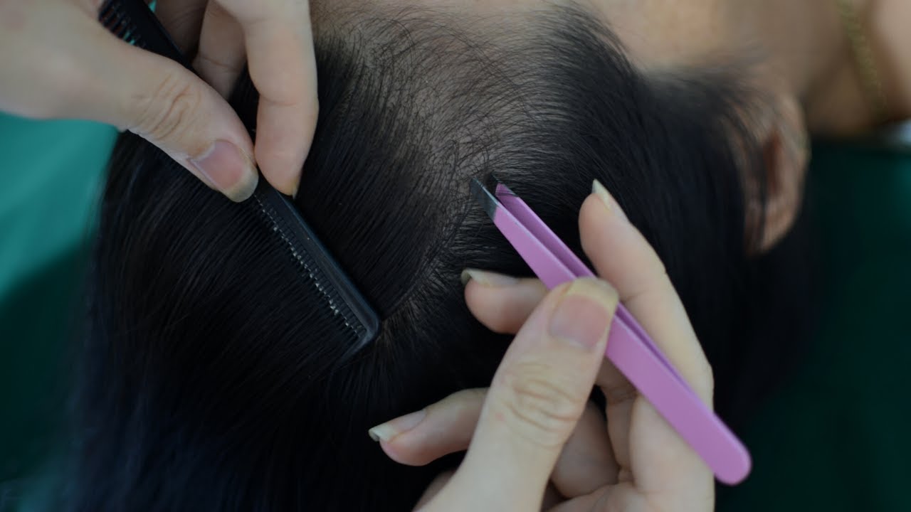 ASMR Scalp Check - Scalp Picking - Plucking White Hair For Relieve Stress, Anxiety ( No Talking )