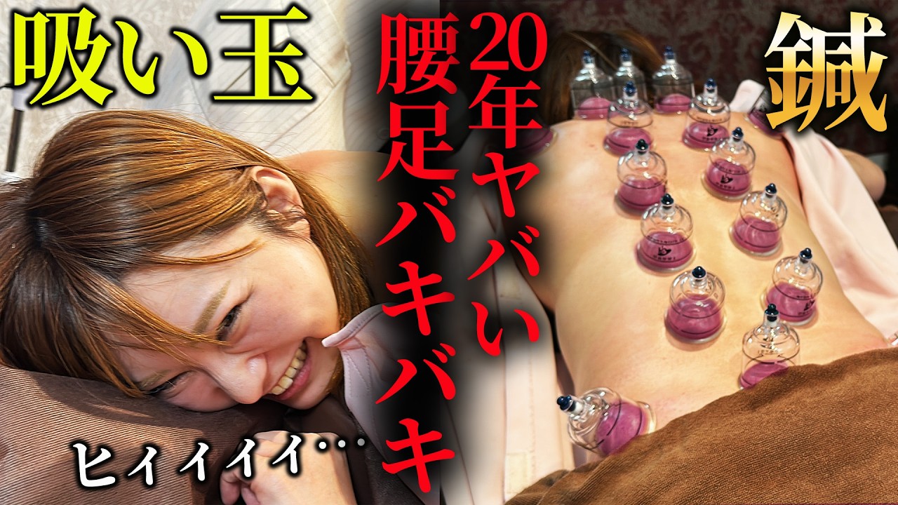 【整体 吸い玉】整体鍼灸と吸い玉で20年来の取れない足腰の痛みを一気に改善　足のむくみ、腰痛、不眠、生理不順など自律神経治療専門鍼灸院【鍼灸院ブレア銀座虎ノ門・元町　東西医学統合研究所】