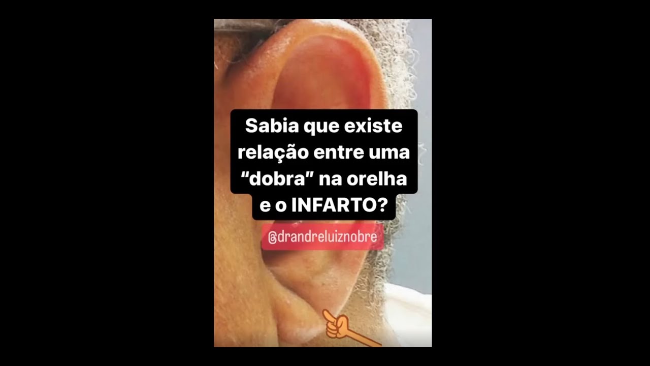 Dobra na orelha e risco de infarto?