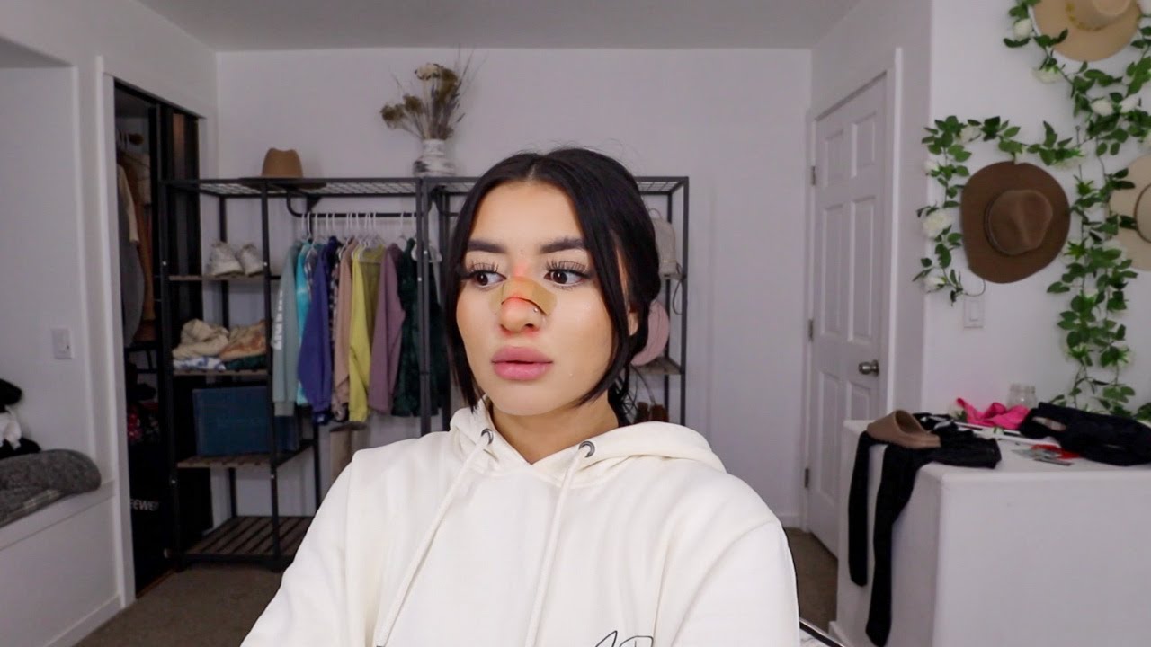 I Got A Nose Job // blancaj