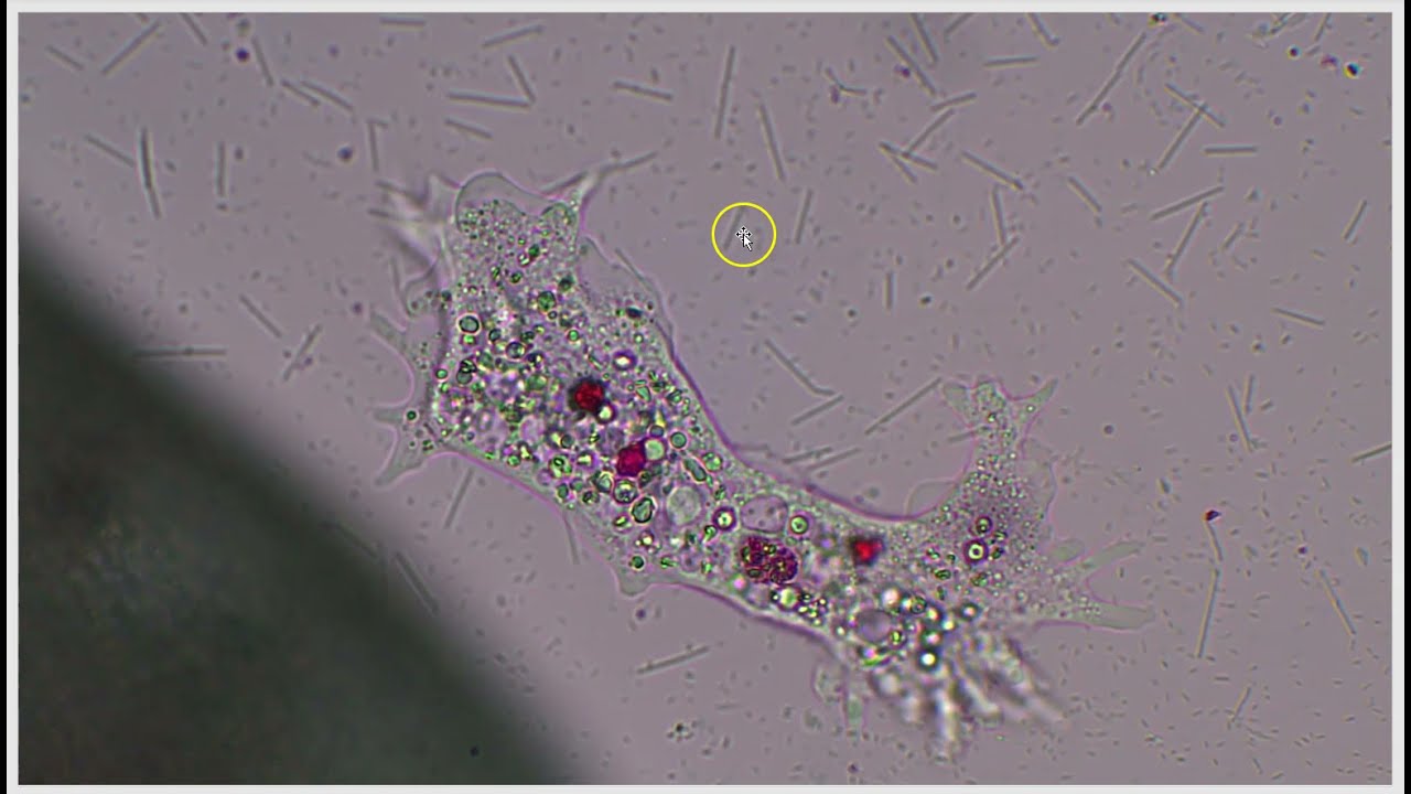 Comparing bacteria to amoeba 2021