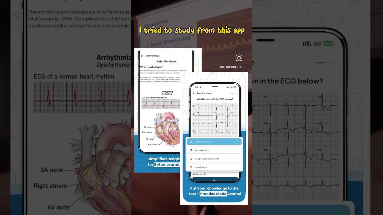 ECG made easy -Best ECG practice app. 