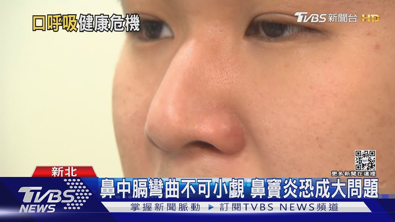 九成人有「鼻中膈彎曲」 嚴重恐致睡眠呼吸中止症!｜十點不一樣20230215@TVBSNEWS02