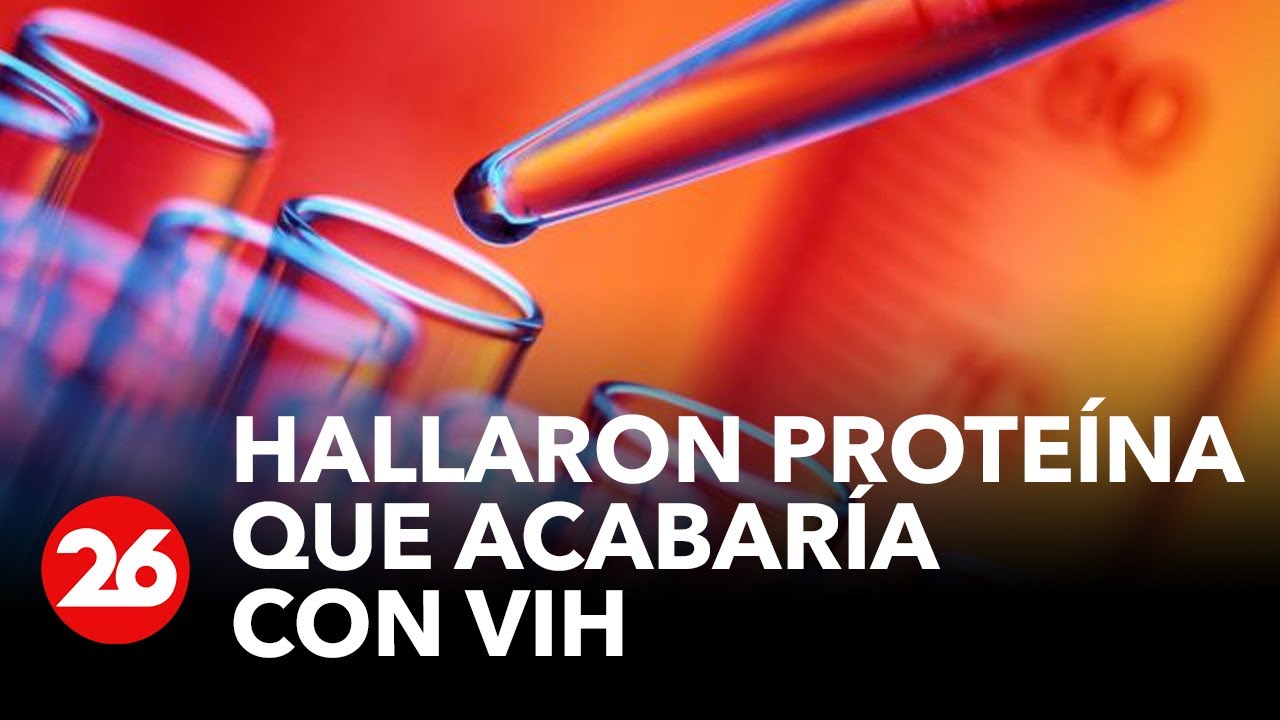ESPAÑA | Investigadores hallan una proteína que podría ayudar a acabar con el VIH