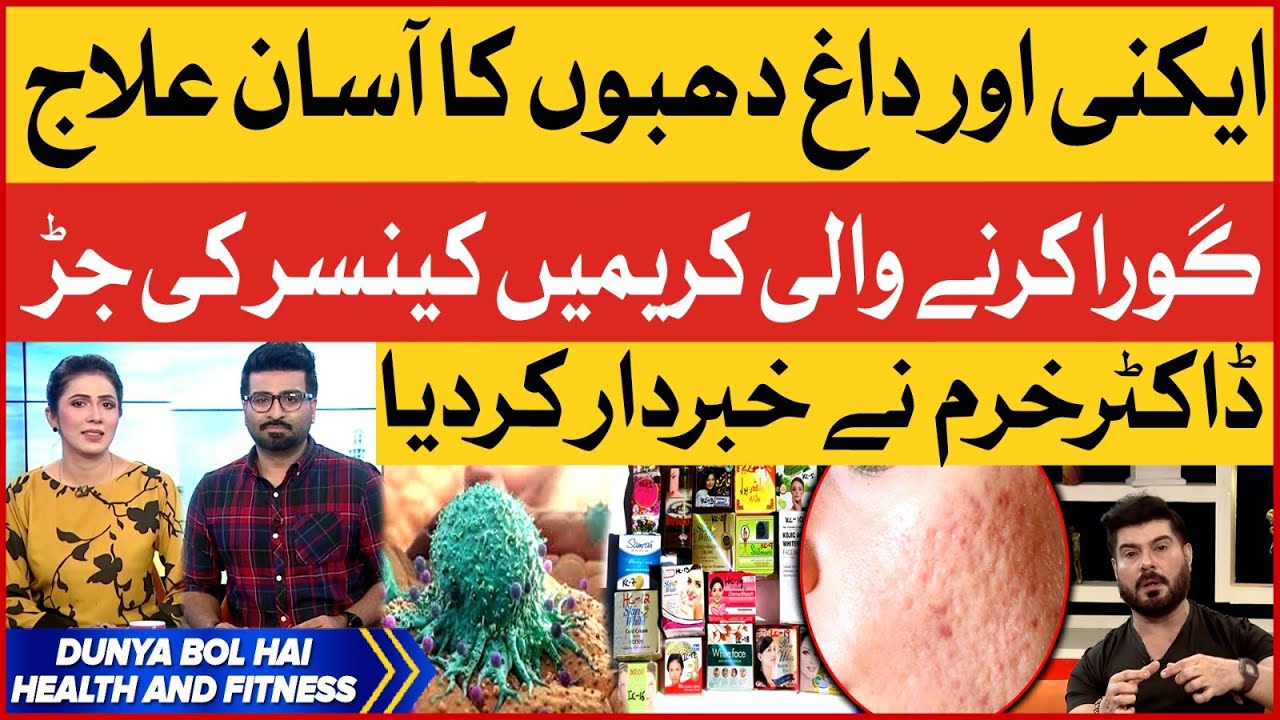 Fairness Creams Causes Cancer in Skin |How to Cure Acne? | Dr Khurram Easy Tips | Breaking News
