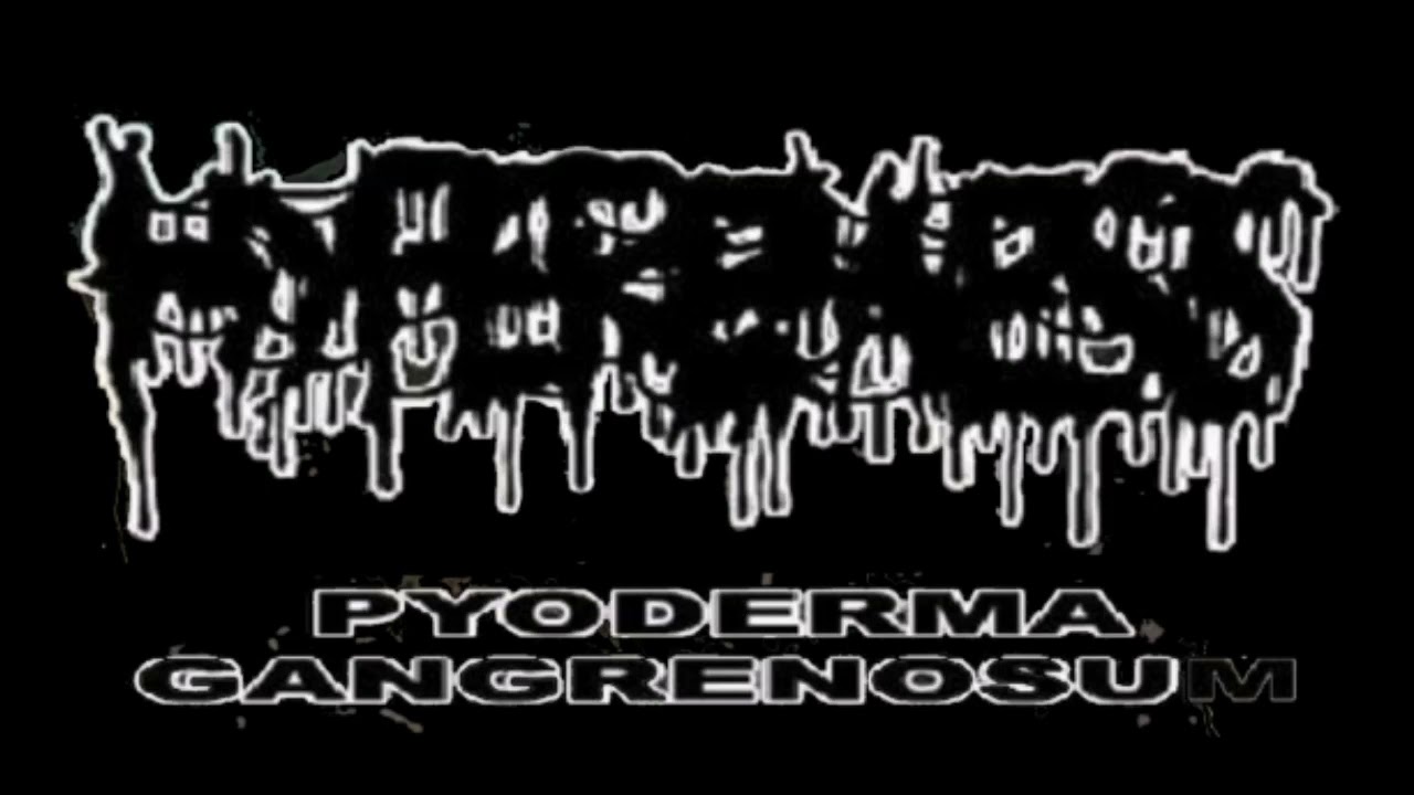 Hyperemesis - split with Infester [FULLALBUM 2011]
