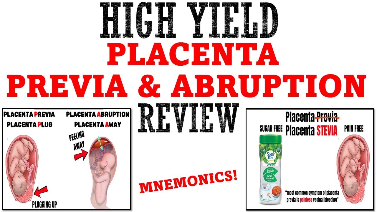 Placenta Previa & Placental Abruption Review | Mnemonics & Proven Ways To Memorize For Your Exam!