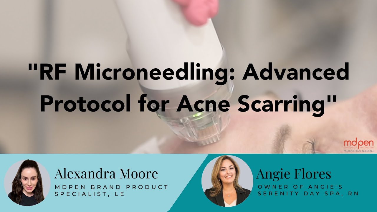 RF Microneedling: Advanced Protocol for Acne Scarring