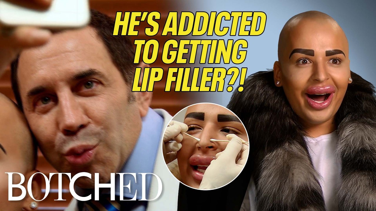 Jordan's Lip Filler is LEAKING But He Keeps Getting More?! | Rejected By Botched | E!