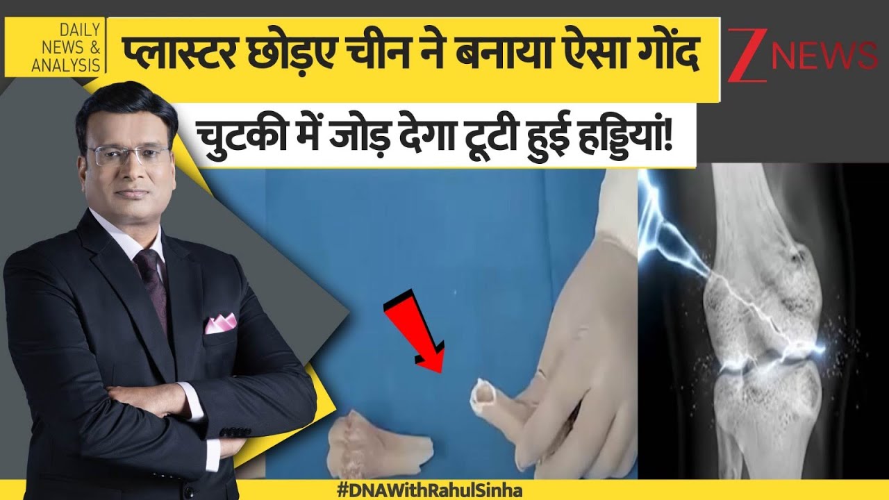 DNA: प्लास्टर छोड़ए चीन ने बनाया ऐसा गोंद चुटकी में जोड़ देगा टूटी हुई हड्डियां! China Bone Glue