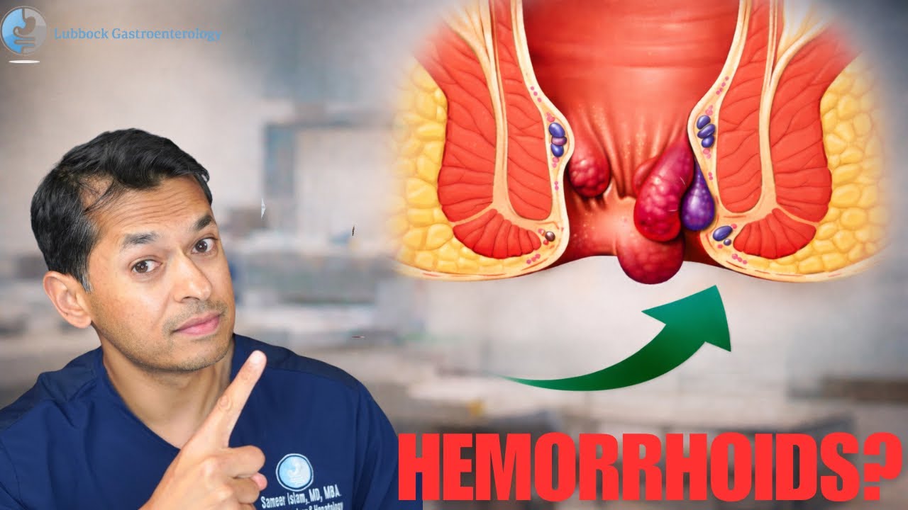 Hemorrhoids Explained: Symptoms, Causes, & When  to See a GI Doctor in Lubbock