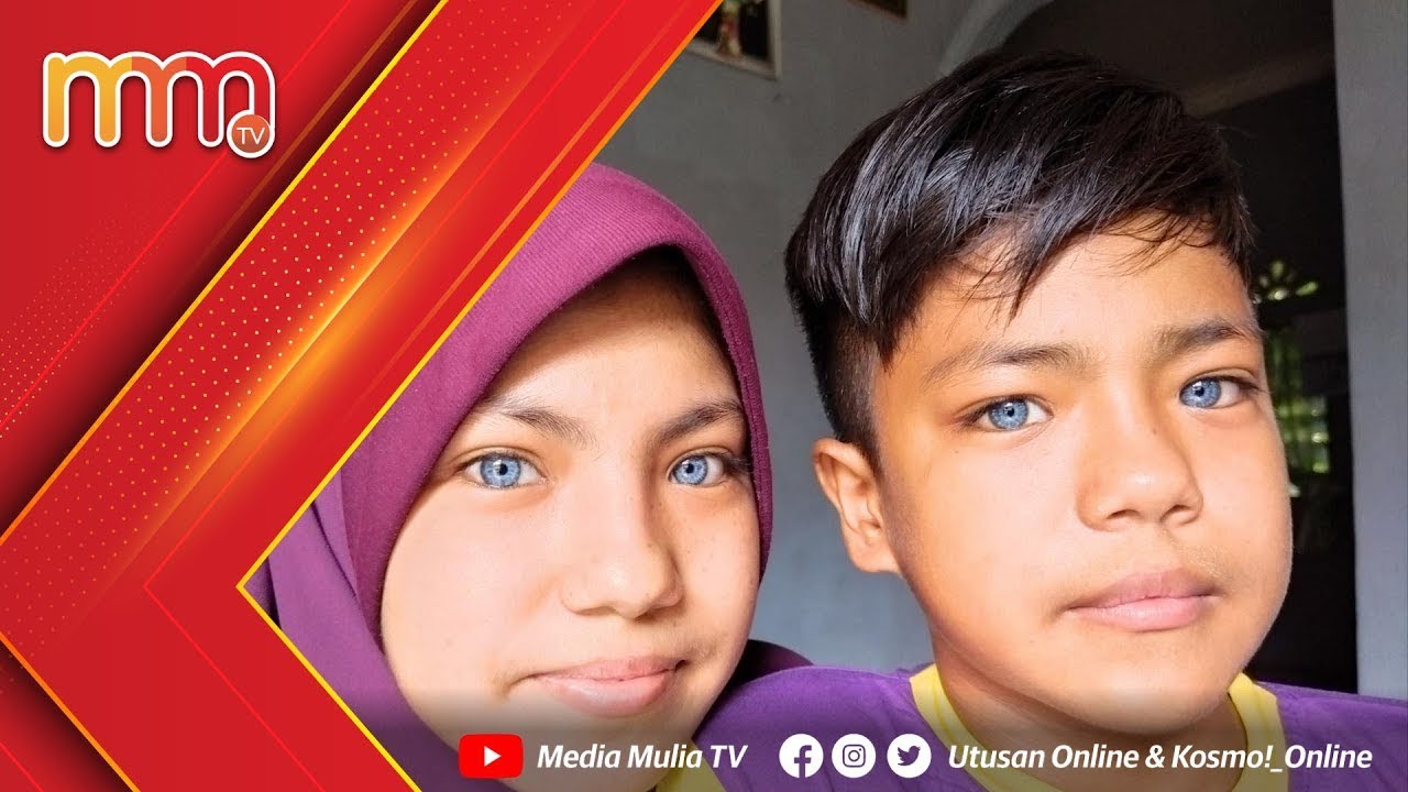 Mata Biru Macam Pakai Kanta Lekap