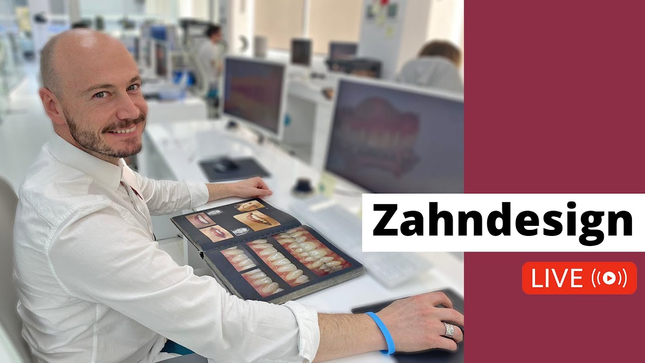 Wie designen wir Deine Zähne?