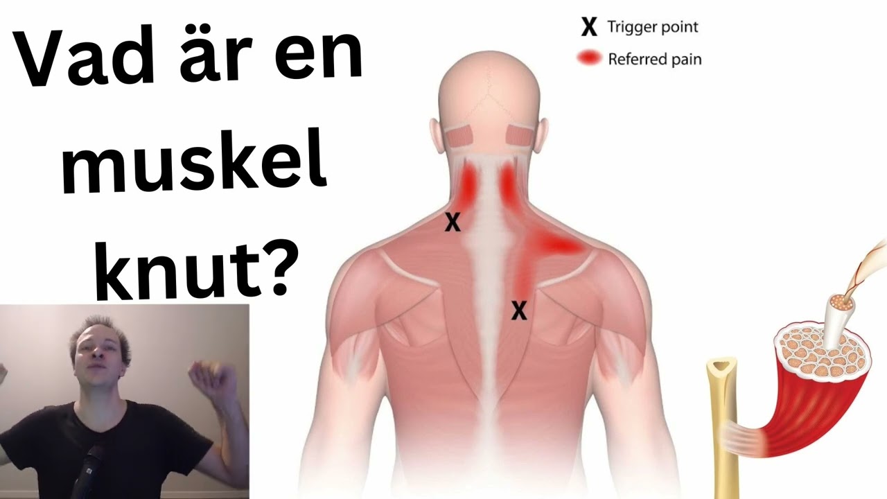 Hur fungerar triggerpunkts behandling?
