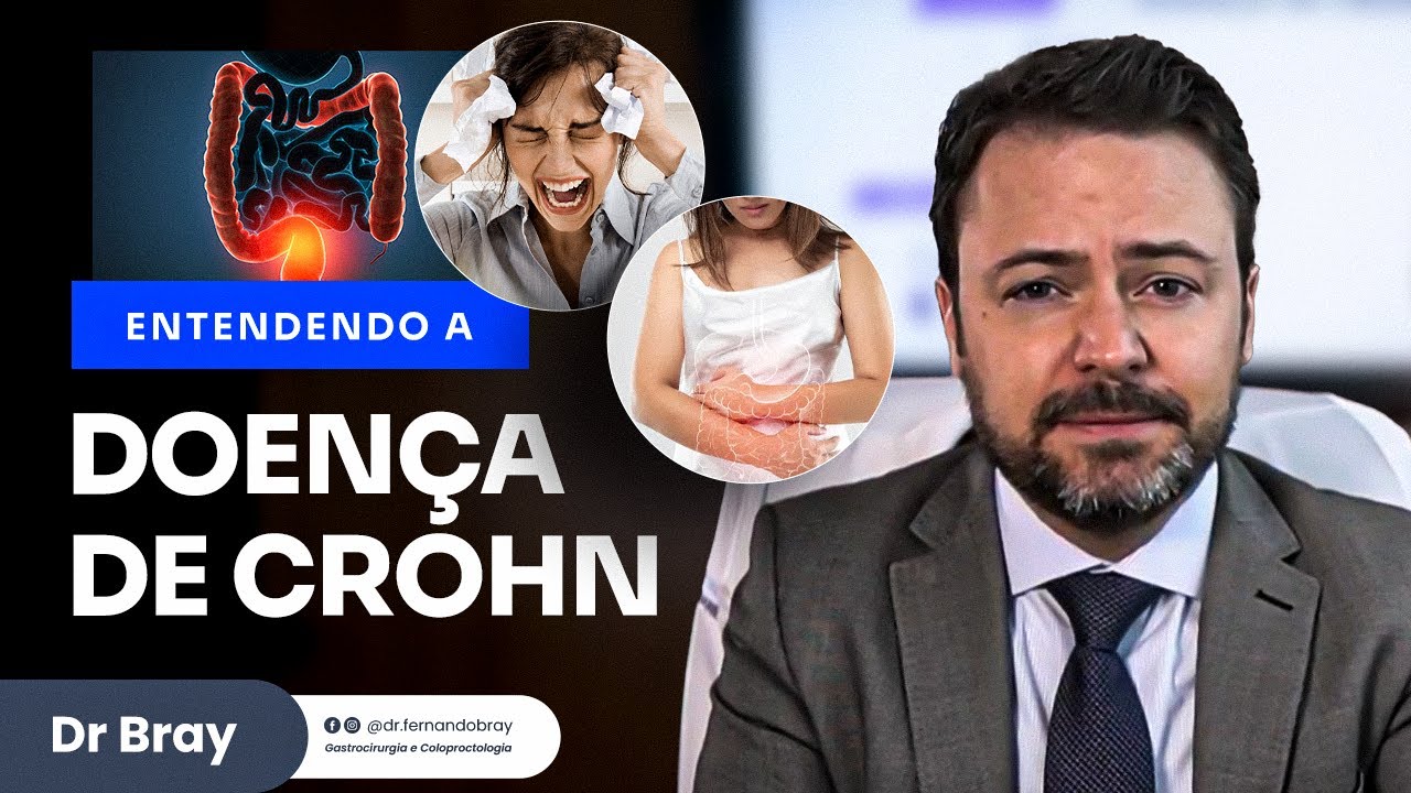 O que &eacute; a doen&ccedil;a de Crohn?