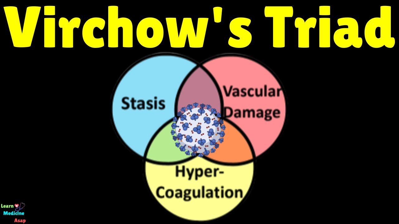Virchow's Triad &ndash; a Risk for Thrombosis Explained | Triad of Virchow