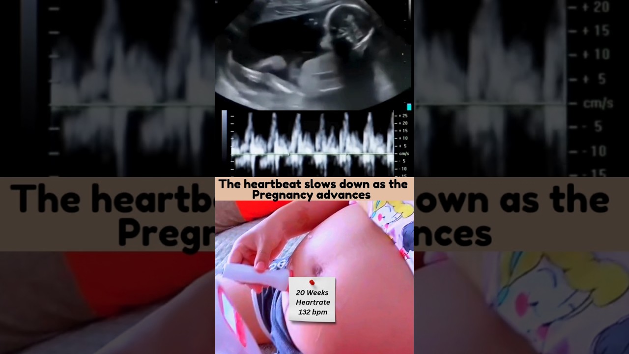 10th Week Vs 20th Week Baby Heartbeat 💓 Fetal Heartbeat with Handheld Doppler