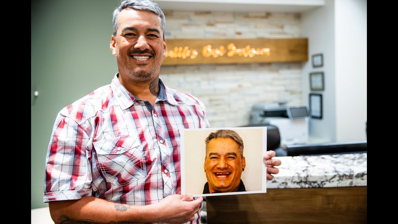 I Couldn’t Have a Conversation—Until I Got My Smile Back | Vince's Dental Implant Story