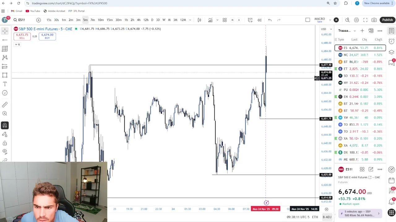 Live Day Trading Making $312,6413 (TRADING SERVERS WENT DOWN MID TRADE)