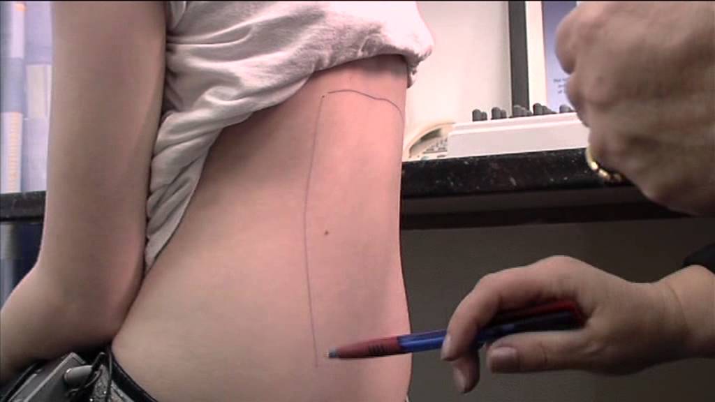 Asthma Allergy Test