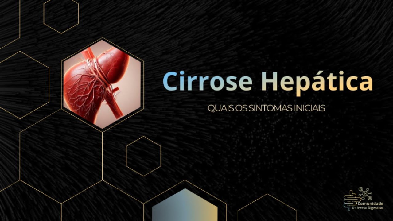 Cirrose Hep&aacute;tica - Quais os Sintomas Iniciais - Dr. Paolo Salvalaggio | Universo Digestivo