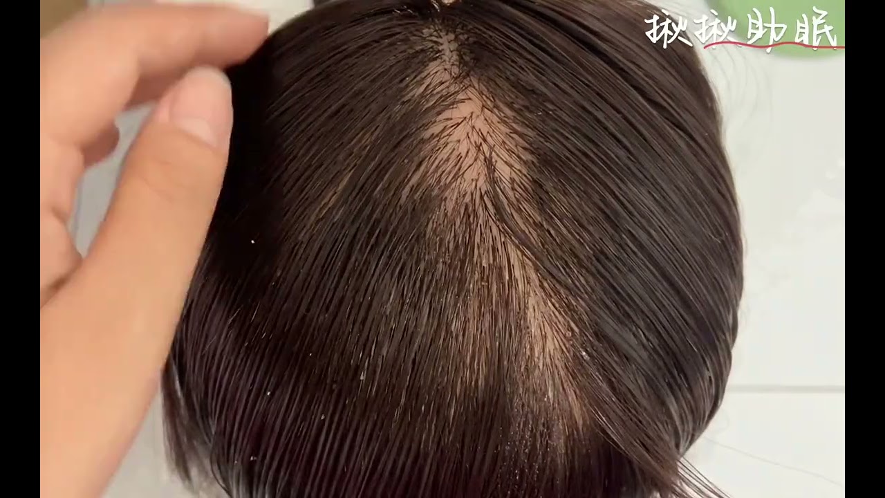 模拟清理头皮屑 密恐者慎入 解压#解压 #asmr助眠视频 #头皮护理 #助眠asmr #场景模拟