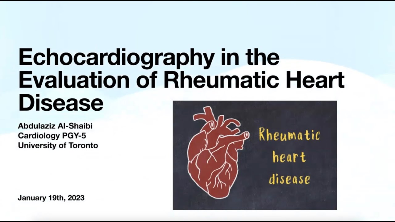 Echocardiographic Assessment of Rheumatic Heart Disease