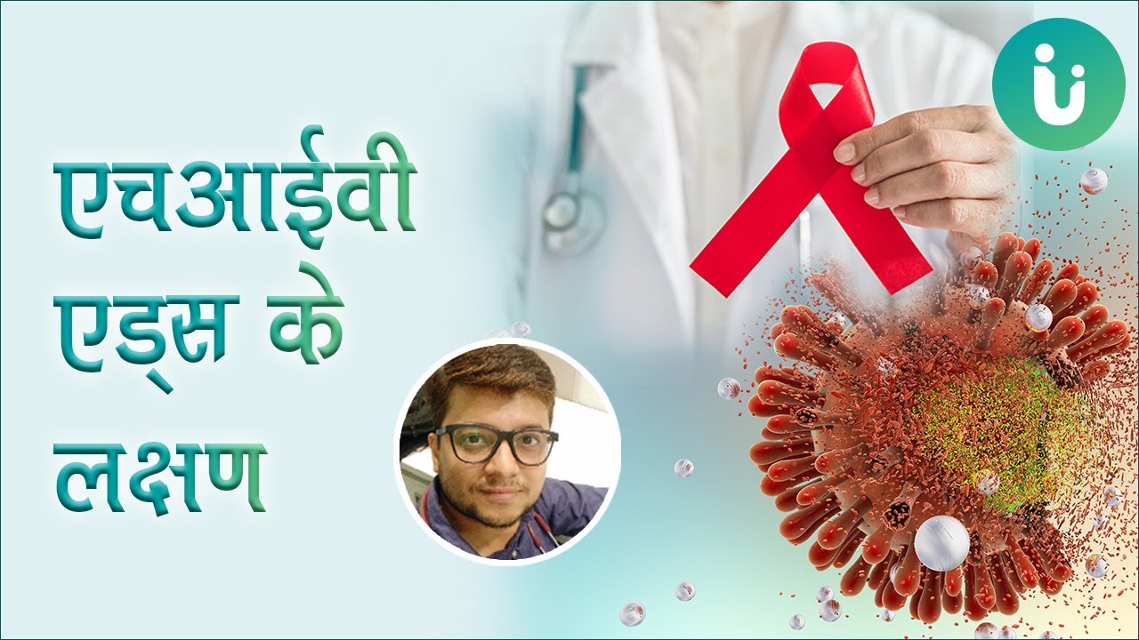 एचआईवी एड्स के लक्षण - HIV AIDS ke lakshan ka pata kaise aur kitne din me chalta hai
