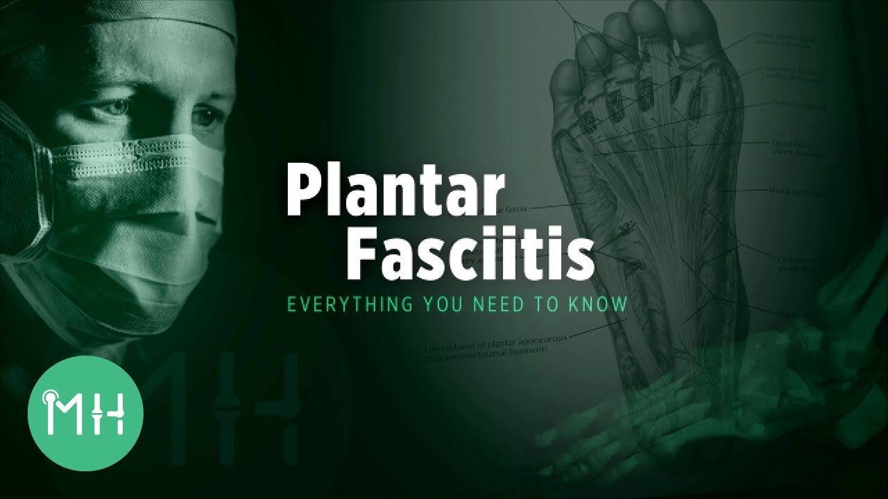 Plantar Fasciitis - Everything you need to know
