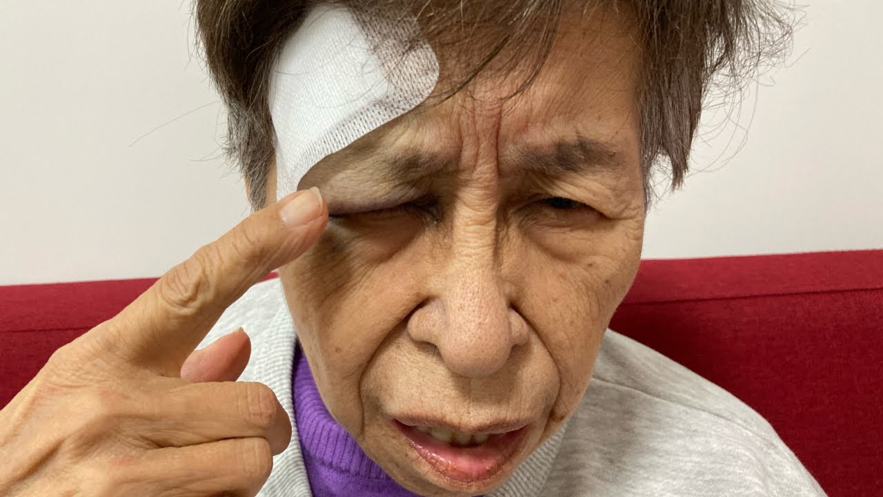 顔が大変なことになりました