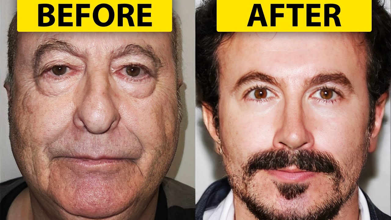 INSANE Plastic Surgery Results - Real or FAKE?
