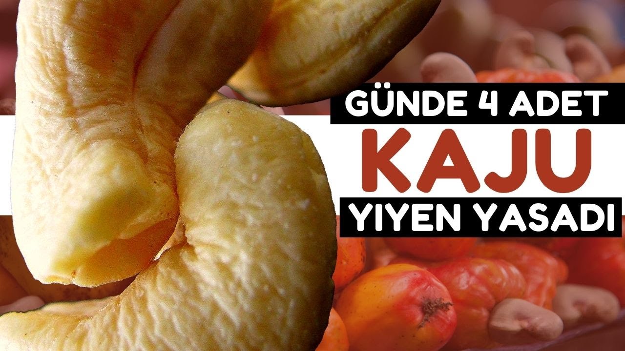 Günde 4 Adet Kaju Vücudunuza Bunları Yapıyor | Kajunun Faydaları Nelerdir?