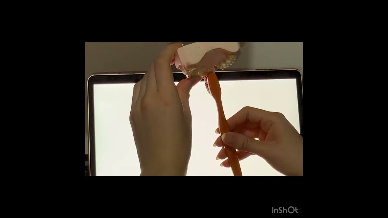 TECNICA DE CEPILLADO PARA PACIENTES CON ENFERMEDAD PERIODONTAL
