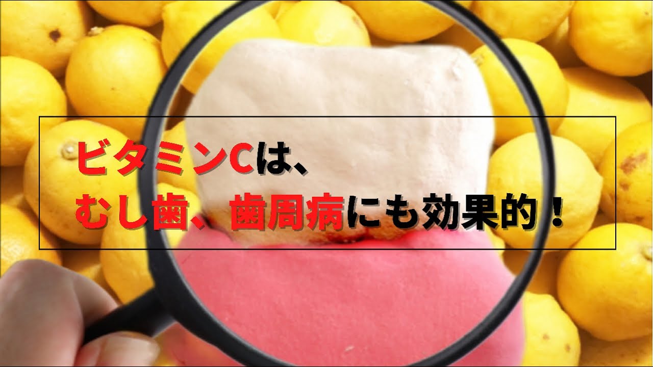 ビタミンCはむし歯・歯周病にも効果的！