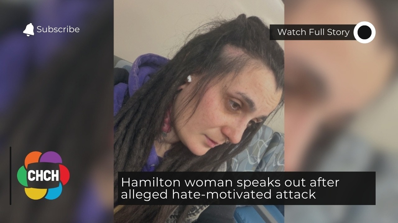 Hamilton woman speaks out after alleged hate-motivated attack