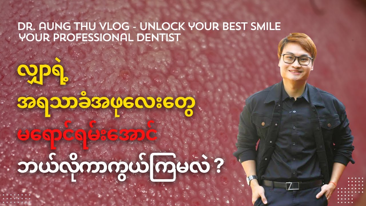 လျှာရဲ့အရသာခံအဖုလေးတွေ မရောင်ရမ်းအောင် ဘယ်လိုကာကွယ်ကြမလဲ?