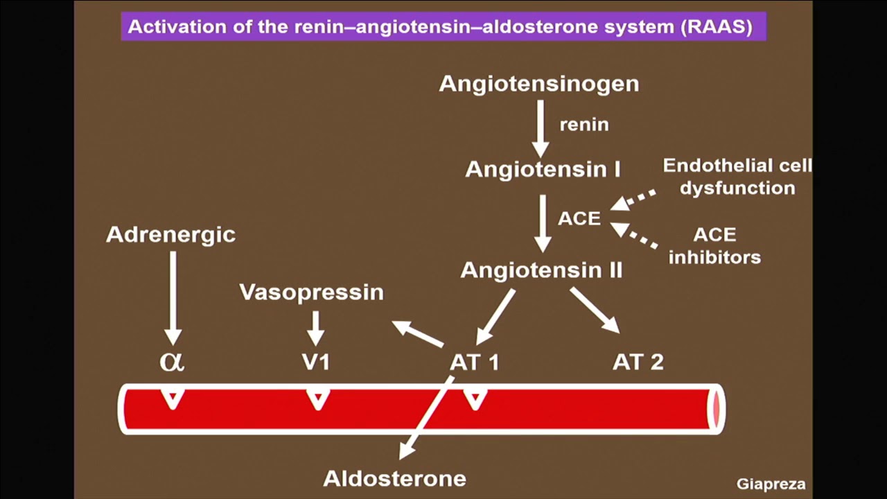 J.L. Vincent - Hypoperfusion is the key