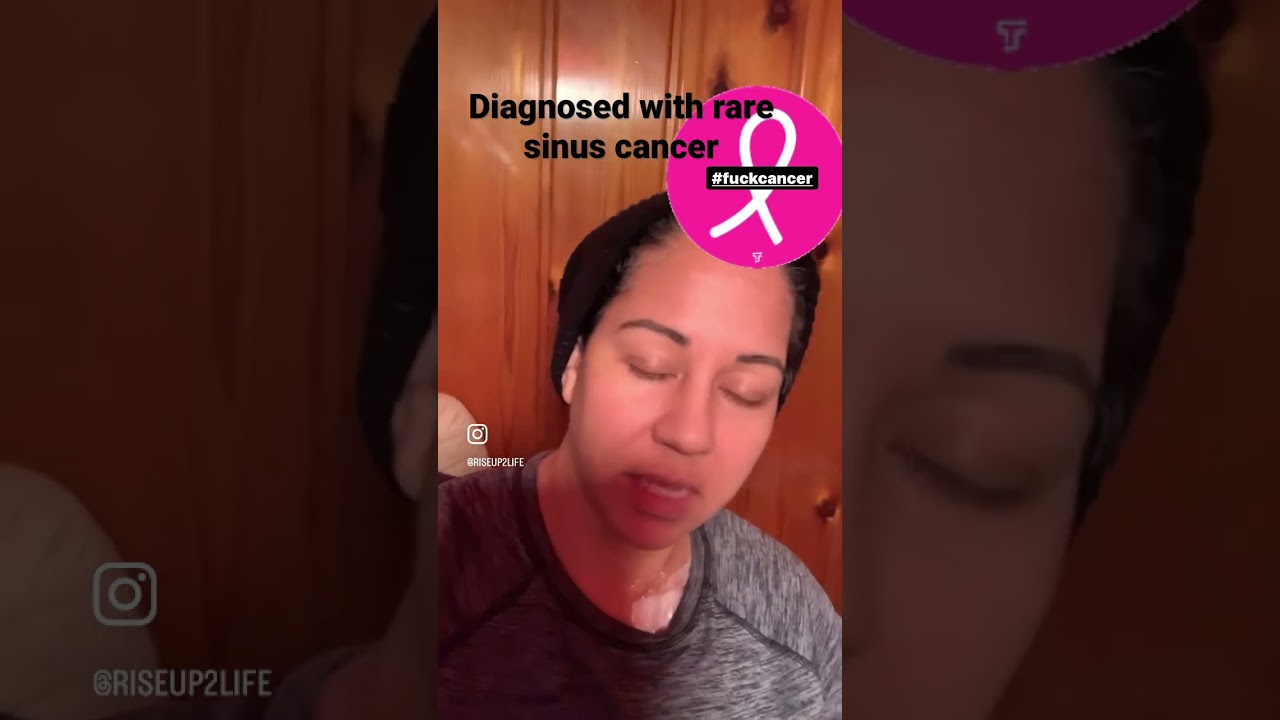Diagnosed with rare sinus alveolar Rhabdomyosarcoma cancer. #DearCancerJournal