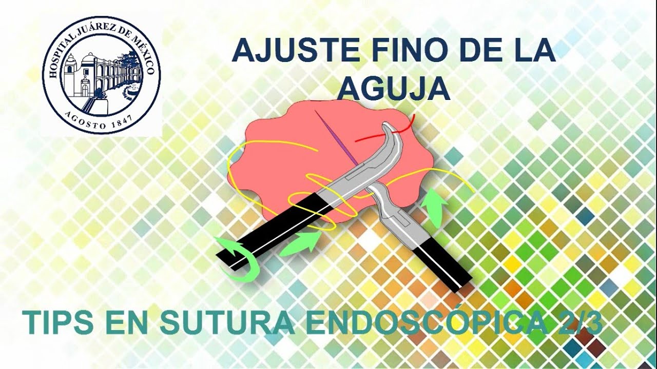 tips en sutura endoscópica 2/3 (ajuste fino de la aguja)